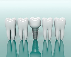 Diagram showing dental implant in Louetta next to natural teeth