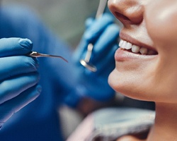Close up of woman receiving dental checkup to prevent gum disease