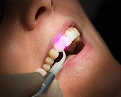 Patient receiving soft tissue laser dentistry treatment