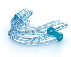An oral sleep appliance