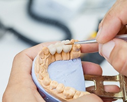 Close-up of a dentist working on a dental bridge in Louetta