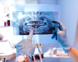 Dentist looking at patient X-ray in Louetta