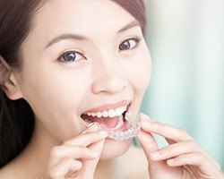 Woman placing Invisalign tray