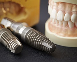 Model of dental implants in Louetta next to model teeth