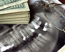 Stack of money resting on a copy of an X-ray