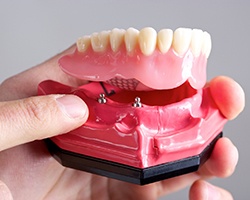 Implant dentist in Houston holding model of an implant denture