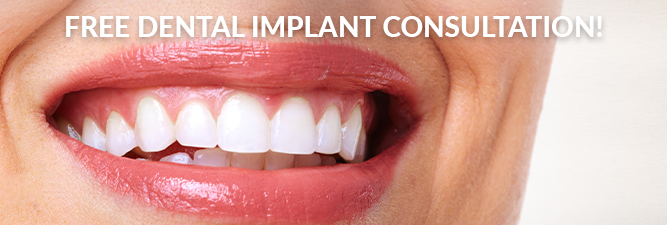 dental implant consultation cpn