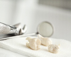 Series of teeth resting next to dental instruments