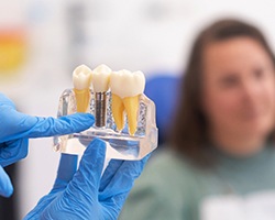A dentist showing a patient a model of dental implants in the jaw