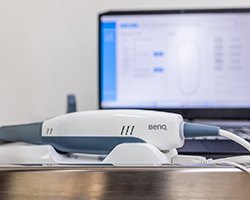 A digital impression system used in dental treatment