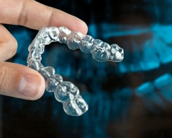 Hand holding an Invisalign aligner