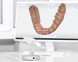 dental scanner in front of monitor showing scan of teeth