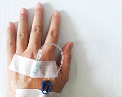 Close-up of IV in patient’s hand