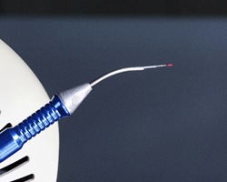 Close-up of soft tissue laser used in dentistry