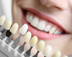 Dental patient having her tooth-shade determined