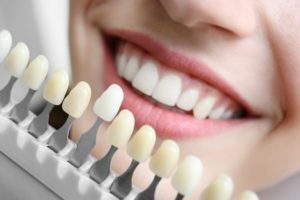 Patient matching veneers to the shade of their teeth.