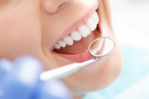 a mouth being examined by a dentist